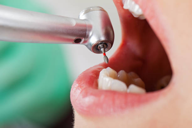 Best Weekend Emergency Dentist in Archbold, OH